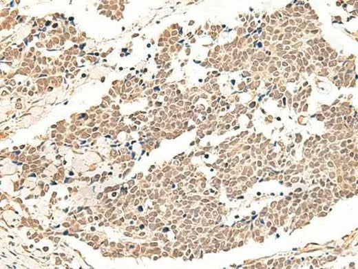 Anti-Human/Mouse/Rat GPR139 Antibody