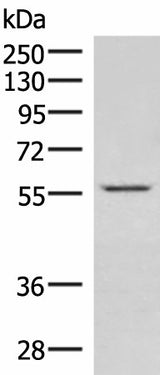 Western blot analysis of Jurkat cell lysate using IPPK Polyclonal Antibody at dilution of 1:550