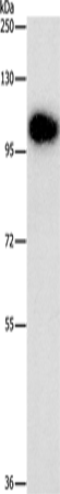 Anti-Human/Mouse/Rat DNM3 Antibody - ABMIUM