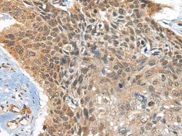 Anti-Human/Mouse BOLA1 Antibody