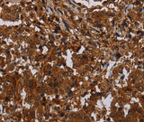 Anti-Human MAGEB18 Antibody - ABMIUM