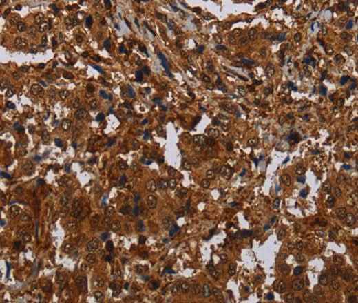 Anti-Human MAGEB18 Antibody