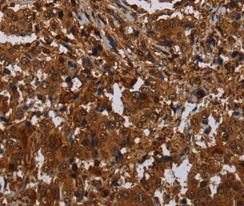 Anti-Human MAGEB18 Antibody - ABMIUM