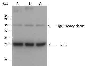 Anti-Human IL33 Antibody [A949] - ABMIUM