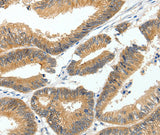 Anti-Human MDK Antibody - ABMIUM