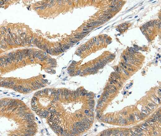 Anti-Human MDK Antibody