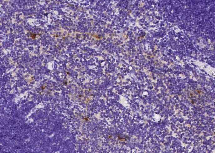 Anti-Rat B2M Antibody [B526] - ABMIUM