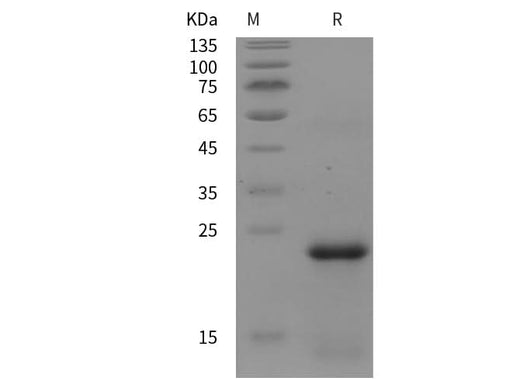 SDS-PAGE analysis of Mouse FTMT proteins, 2 μg/lane of Recombinant Mouse FTMT proteins was resolved with SDS-PAGE under reducing conditions, showing bands at 24 kDa.