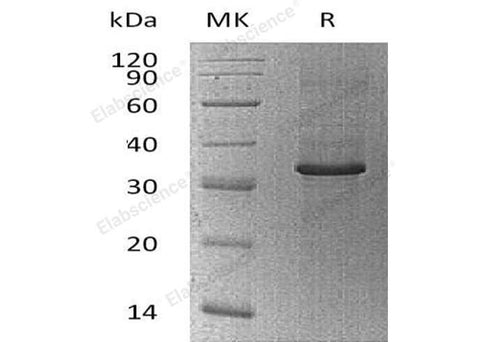 Recombinant Human Cyclophilin C/PPIC Protein (His&Trx Tag) - ABMIUM