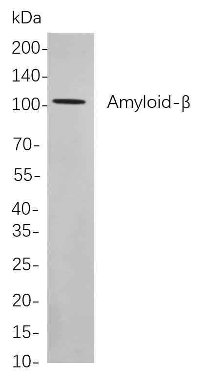 Anti-Human/Mouse/Rat Amyloid-β Antibody [B833] - ABMIUM