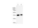 Anti-Human GLα Antibody - ABMIUM