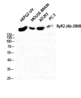 Western Blot analysis of HepG2-UV, Mouse brain, AD293T, PC-3 using RYR2 Polyclonal Antibody at dilution of 1:2000.
