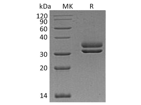 Recombinant Human CFHR2 Protein (His Tag) - ABMIUM