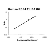 Human RBP4/Retinol Binding Protein 4 EZ-Set™ ELISA Kit (DIY Antibody Pairs) Boster Bio