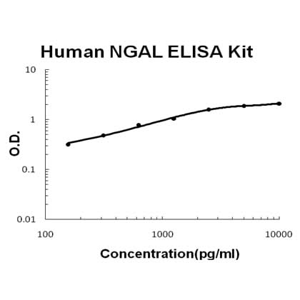 Human Lipocalin-2/NGAL ELISA Kit EZ-Set™ (DIY Antibody Pairs) Boster Bio