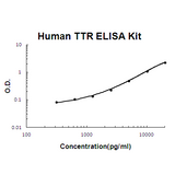 Human Transthyretin/TTR ELISA Kit EZ-Set™ (DIY Antibody Pairs) Boster Bio