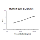 Human B2M ELISA Kit EZ-Set™ (DIY Antibody Pairs) Boster Bio