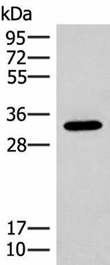 Western blot analysis of Mouse liver tissue lysate using RGR Polyclonal Antibody at dilution of 1:300