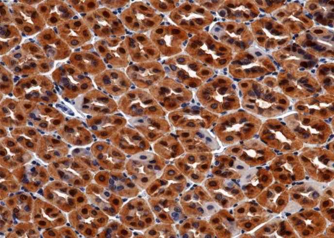 Anti-Mouse CA2 Antibody [B474] - ABMIUM