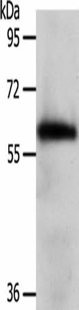 Western blot analysis of Mouse brain tissue using WDR1 Polyclonal Antibody at dilution of 1:1000