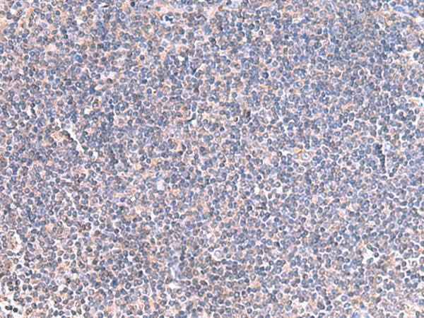 Anti-Human/Mouse/Rat GRIA2 Antibody