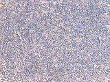 Immunohistochemistry of paraffin-embedded Human tonsil tissue using GRIA2 Polyclonal Antibody at dilution of 1:40(×200)