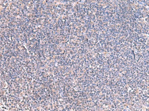 Immunohistochemistry of paraffin-embedded Human tonsil tissue using GRIA2 Polyclonal Antibody at dilution of 1:40(×200)