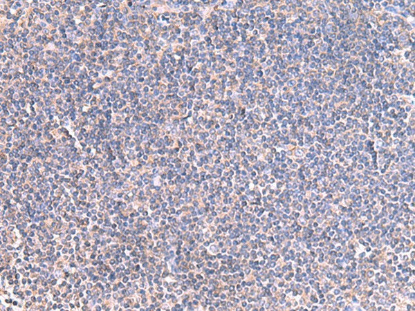 Immunohistochemistry of paraffin-embedded Human tonsil tissue using GRIA2 Polyclonal Antibody at dilution of 1:40(×200)