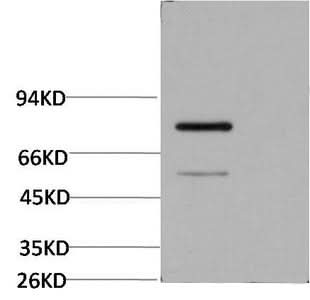 Western Blot analysis of Firefly Luciferase Transfected Hela using Luciferase Monoclonal Antibody at dilution of 1:2000.