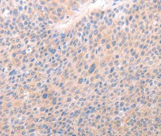 Anti-Human/Mouse/Rat ACO1 Antibody