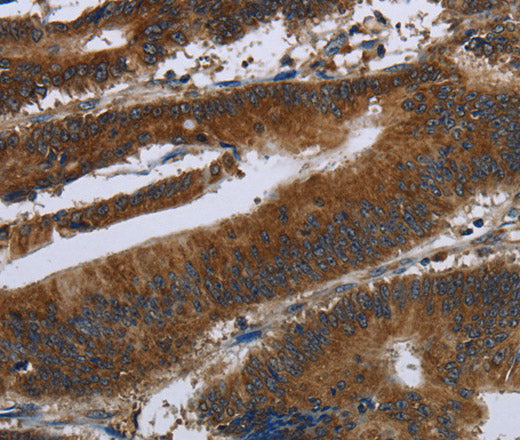 Anti-Human/Mouse ARHGEF12 Antibody - ABMIUM