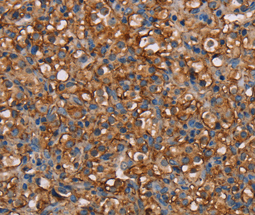 Anti-Human/Mouse NEDD4L Antibody - ABMIUM