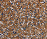 Anti-Human IRGM Antibody - ABMIUM