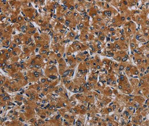 Anti-Human IRGM Antibody