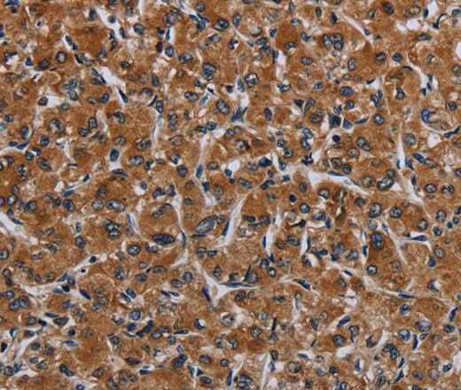 Anti-Human IRGM Antibody
