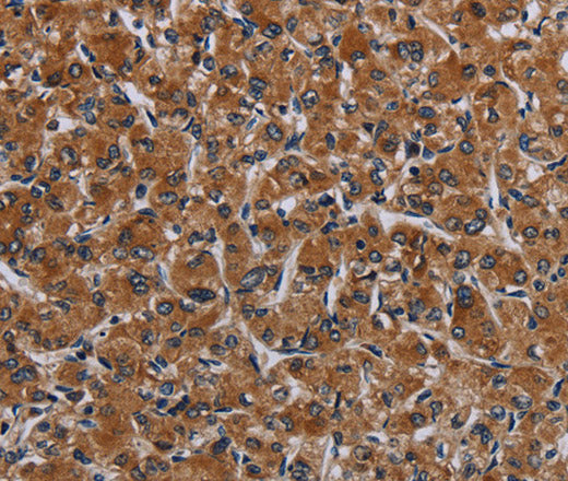 Anti-Human IRGM Antibody - ABMIUM