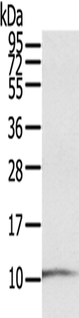 Anti-Human S100P Antibody - ABMIUM