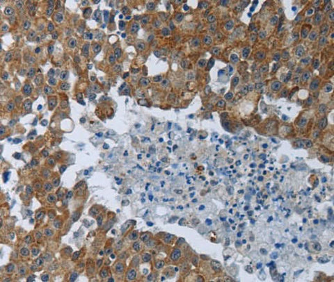 Anti-Human EIF2AK2 Antibody - ABMIUM