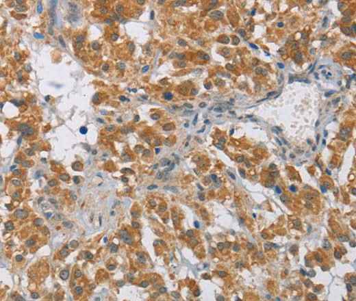 Anti-Human DIDO1 Antibody