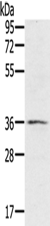 Anti-Human/Mouse RNF144B Antibody - ABMIUM