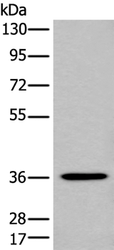 Anti-Human NCR1 Antibody - ABMIUM
