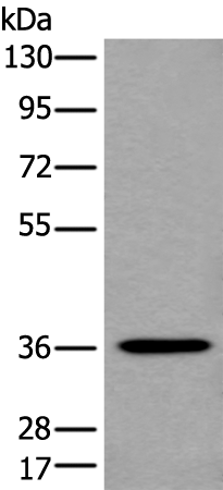 Anti-Human NCR1 Antibody - ABMIUM