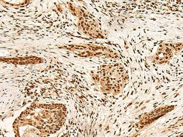 Anti-Human/Mouse/Rat PAFAH1B2 Antibody