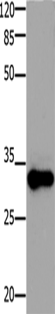 Anti-Human/Mouse ADO Antibody - ABMIUM