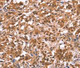 Anti-Human/Mouse AMER1 Antibody - ABMIUM