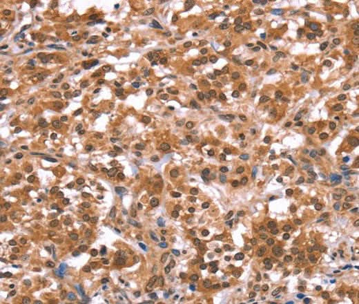 Anti-Human/Mouse AMER1 Antibody - ABMIUM