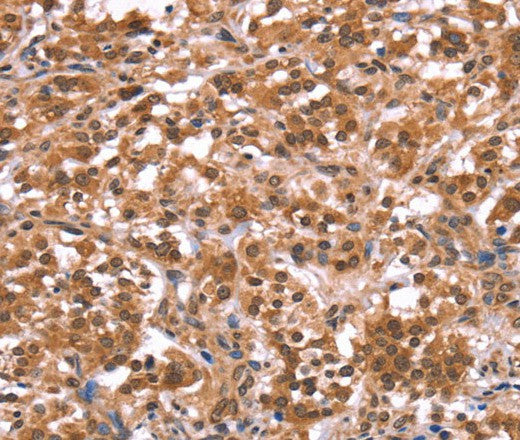 Anti-Human/Mouse AMER1 Antibody - ABMIUM