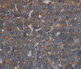 Anti-Human LETMD1 Antibody - ABMIUM