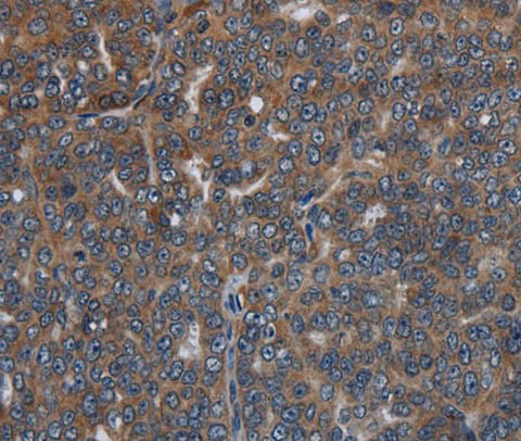 Anti-Human LETMD1 Antibody - ABMIUM