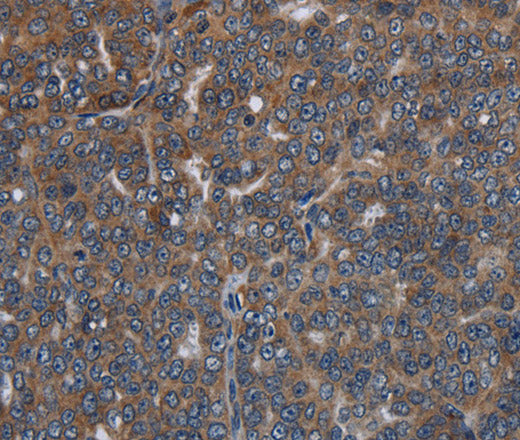 Anti-Human LETMD1 Antibody - ABMIUM